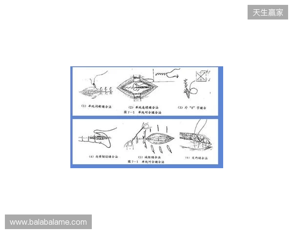 广州豹官方：杨浩眉弓伤口缝合30余针，预计5-7天后拆线